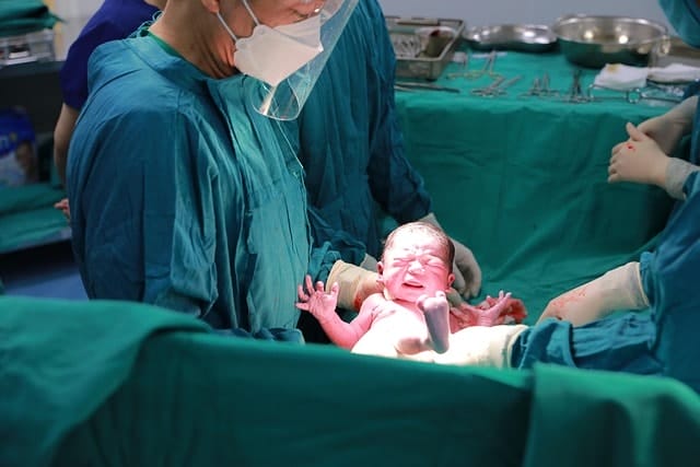 baby, newborn, cesarean section, delivery room, doctor, surgeon, umbilical cord cutting, child, cesarean section, cesarean section, cesarean section, cesarean section, cesarean section, delivery room, delivery room, delivery room, delivery room
